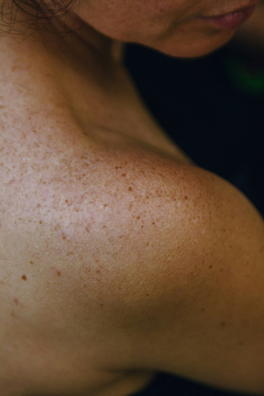 Astaxanthin: nature’s skin protector