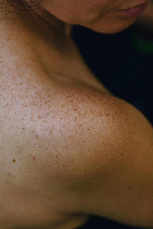 Astaxanthin: nature’s skin protector