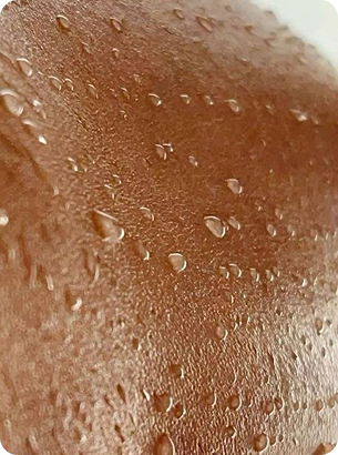 Why inflammation shows up on your skin